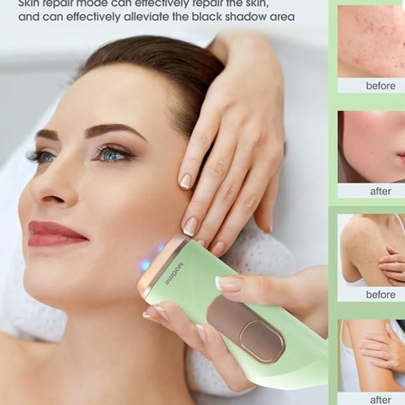 Laser Hair Removal for Women - Picture 6 of 6